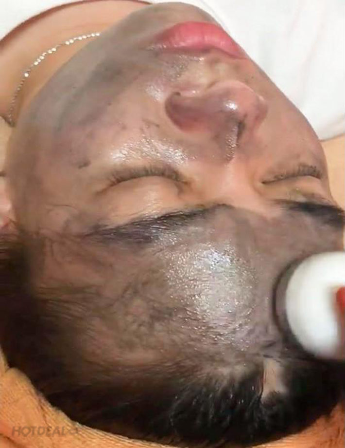 Chăm Sóc Da Mặt Thải Chì Sáng Bừng Sức Sống Tại Venus Spa