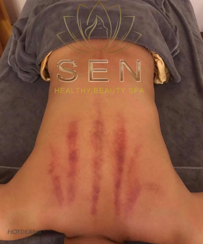 Dưỡng Sinh Kinh Lạc - Chăm Sóc Sức Khỏe Tại Sen Healthy Beauty Spa