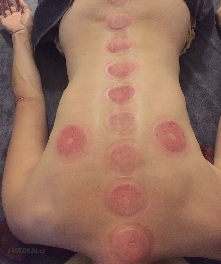 Dưỡng Sinh Kinh Lạc - Chăm Sóc Sức Khỏe Tại Sen Healthy Beauty Spa