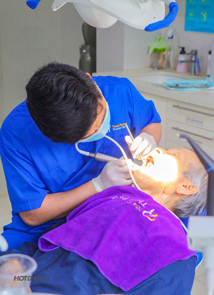 Nha Khoa Thanh Phương - Chăm Sóc Răng Miệng, Lấy Cao Răng